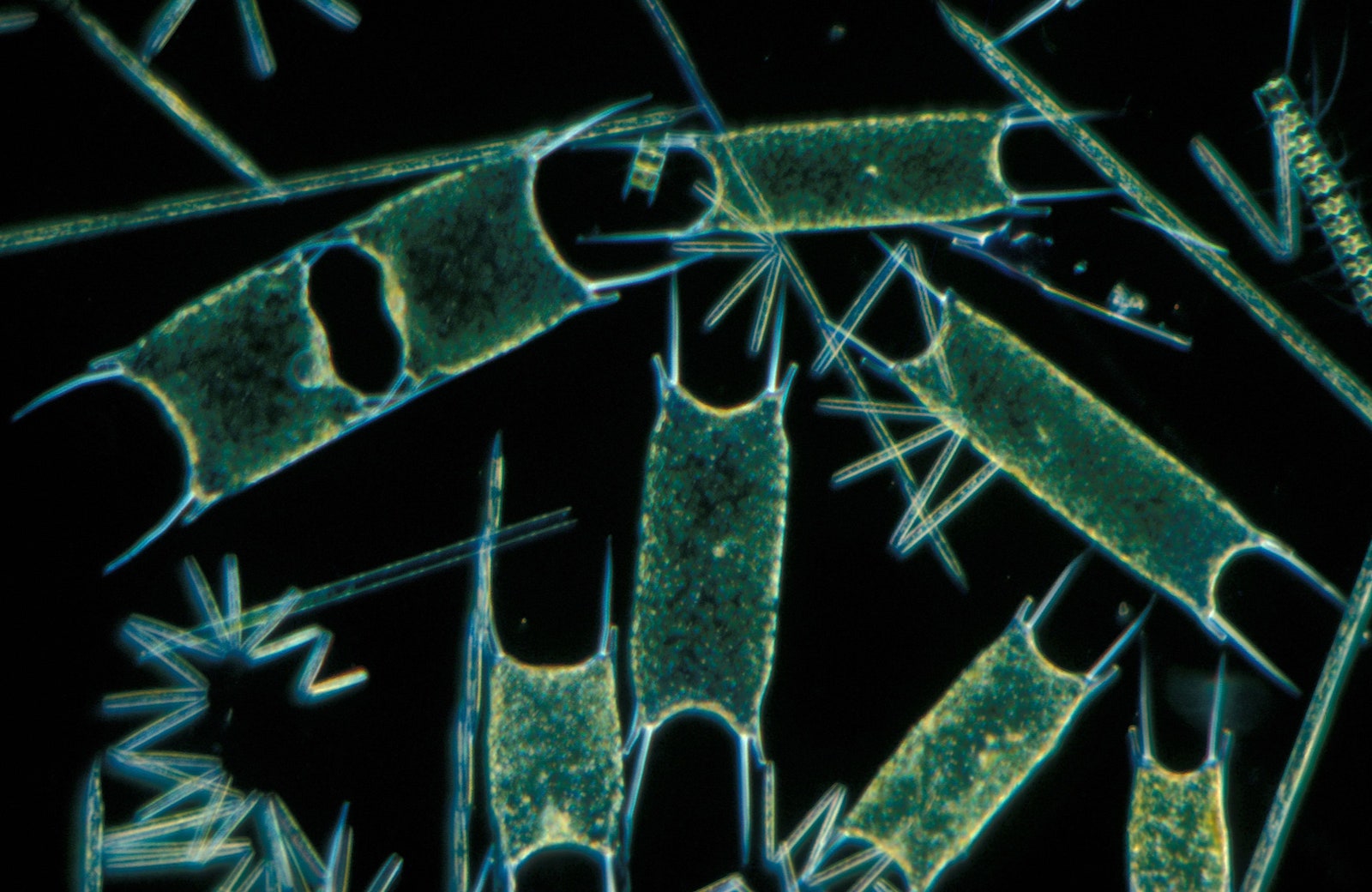Microscopic photo of green phytoplankton on a black background